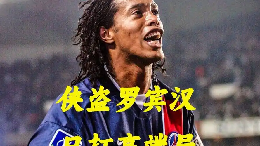 视球员的状
